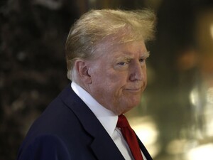 У Трампа виявили проблеми зі здоров'ям. У Білому домі розкрили результати медогляду президента